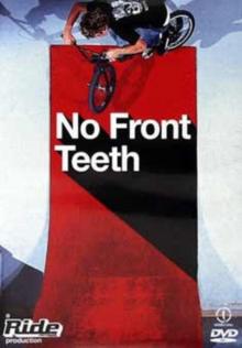 No Front Teeth